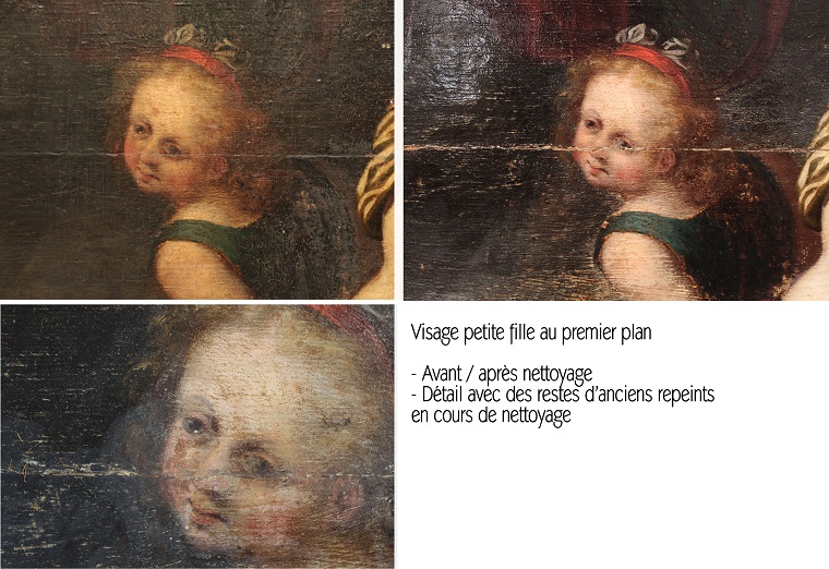 Visage petite fille au premier plan (avant/après nettoyage / Détail avec des restes d'anciens repeints en cours de nettoyage)